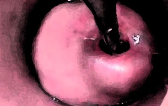 私の蟲姦遊び 19話 妊娠中に2匹のゴキブリの幼虫編(シングルママの日常) - FANZA同人