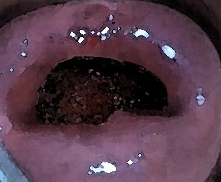 私の蟲姦遊び 17 話 妊娠中にスズメガのサナギ編(シングルママの日常) - FANZA同人