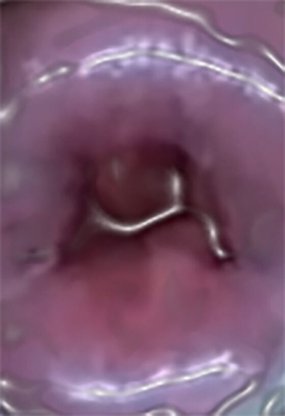 私の蟲姦遊び 17 話 妊娠中にスズメガのサナギ編(シングルママの日常) - FANZA同人