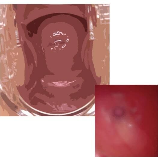 私の蟲姦遊び 第11話 妊娠中にカミキリ虫の幼虫とゴキブリの卵編 全編(シングルママの日常) - FANZA同人