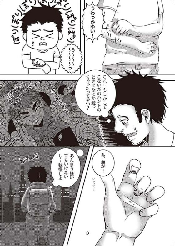 痒い [もぎらぼ] | DLsite がるまに